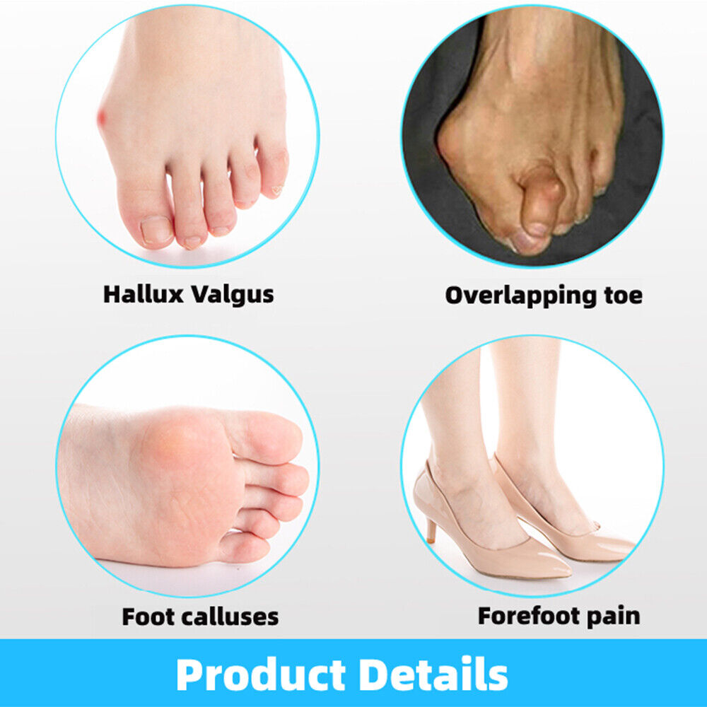 HappyToes™ Bunion Fix